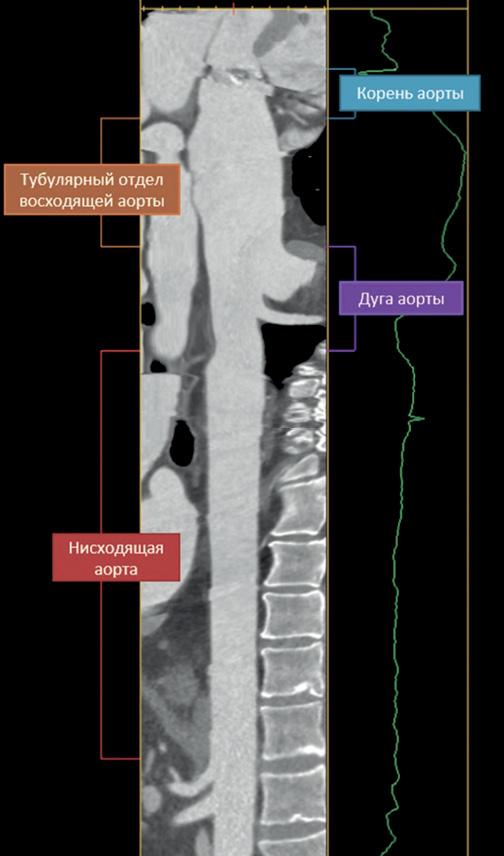 Изображение на обложке